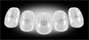 Dodge Ram 1999-2002 CLEAR LED Cab Lights (5 Piece set)